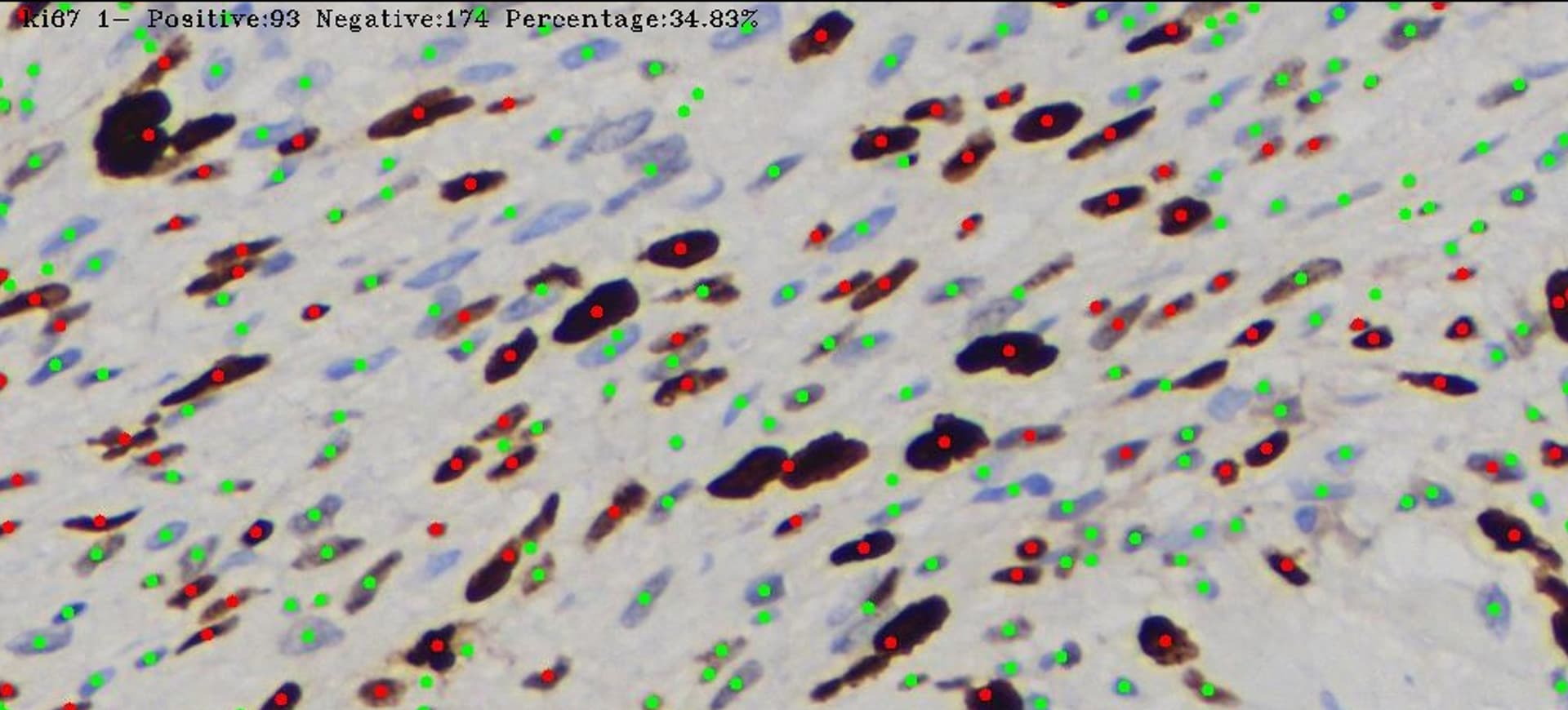 Nuclei Result